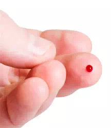 muestras sangre adn solutions