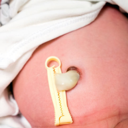 muestras adn prueba test paternidad cordón umbilical